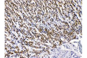 AKR1B1 was detected in paraffin-embedded sections of rat adrenal gland tissues using rabbit anti- AKR1B1 Antigen Affinity purified polyclonal antibody (Catalog # ) at 1 µg/mL. (AKR1B1 antibody  (AA 228-316))