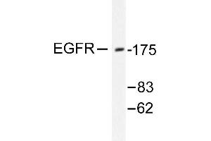Image no. 1 for anti-Epidermal Growth Factor Receptor (EGFR) antibody (ABIN265395) (EGFR antibody)