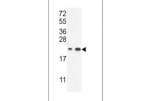 Western blot analysis in A2058,T47D cell line lysates (35ug/lane). (ABHD14B antibody  (C-Term))
