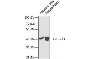 Western blot analysis of extracts of various cell lines using L2HGDH Polyclonal Antibody at dilution of 1:1000. (L2HGDH antibody)