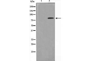 Western blot analysis on HeLa cell lysate using ZNF225 Antibody,The lane on the left is treated with the antigen-specific peptide. (ZNF225 antibody  (C-Term))