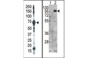 Image no. 1 for anti-Phosphatidylinositol-4-Phosphate 5-Kinase, Type I, gamma (PIP5K1C) (C-Term) antibody (ABIN360481) (PIP5K1C antibody  (C-Term))