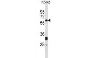 Western Blotting (WB) image for anti-N-Myristoyltransferase 2 (NMT2) antibody (ABIN2998073) (NMT2 antibody)