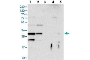 Western blot analysis of Lane 1: RT-4, Lane 2: U-251 MG, Lane 3: Human Plasma, Lane 4: Liver, Lane 5: Tonsil with FAM125A polyclonal antibody  at 1:100-1:250 dilution. (FAM125A antibody)