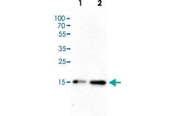 HIST1H3A anticorps  (acLys4)