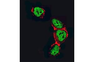 Confocal immunofluorescent analysis of HDAC2 Antibody (C-term) (ABIN6242378 and ABIN6577318) with 293 cell followed by Alexa Fluor 488-conjugated goat anti-rabbit lgG (green).