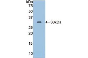 Detection of Recombinant PLS3, Human using Polyclonal Antibody to Plastin 3 (PLS3) (Plastin 3 antibody  (AA 379-630))