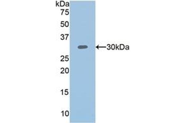 Plastin 3 anticorps  (AA 379-630)