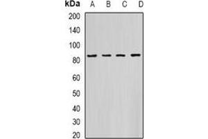 Western blot analysis of HADHA expression in K562 (A), PC3 (B), Hela (C), mouse heart (D) whole cell lysates. (HADHA antibody)