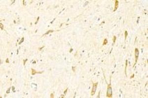 Immunohistochemistry analysis of paraffin-embedded mouse spinal cord using ADAMTS4 (ABIN7072947) at dilution of 1: 3000 (ADAMTS4 antibody)