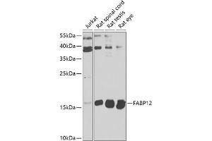 Western blot analysis of extracts of various cell lines, using F antibody  at 1:1000 dilution. (FABP12 antibody  (AA 1-140))