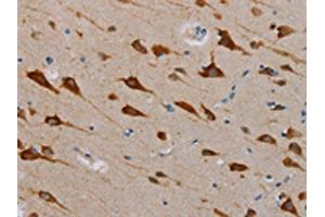 The image is immunohistochemistry of paraffin-embedded Human brain tissue using ABIN7131284(TAB3 Antibody) at dilution 1/25. (TAB3 antibody)