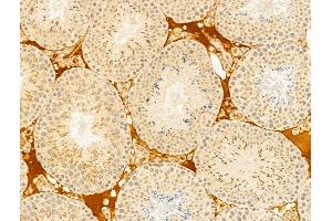 anti-WD Repeat and SOCS Box Containing 1 (WSB1) (Internal Region) antibody