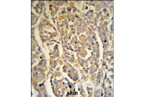 DCD Antibody (RB18706) IHC analysis in formalin fixed and paraffin embedded human skin tissue followed by peroxidase conjugation of the secondary antibody and DAB staining. (Dermcidin antibody  (C-Term))