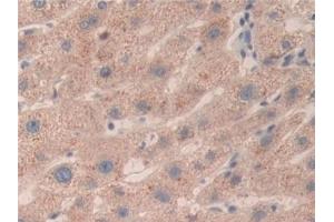 Detection of SMC3 in Human Liver Tissue using Polyclonal Antibody to Structural Maintenance Of Chromosomes Protein 3 (SMC3) (SMC3 antibody  (AA 994-1181))