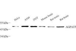 Western blot analysis of AGPAT5 (ABIN7072838) at dilution of 1: 300 (AGPAT5 antibody)