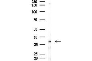 anti-CD2 (Cytoplasmic Tail) Binding Protein 2 (CD2BP2) (Internal Region) antibody