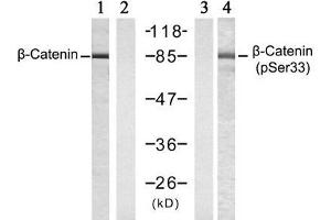 Western blot analysis of extracts from SW 626 cells , untreated or treated with Calyculin A (50nM, 30min), using β-Catenin (Ab-33) antibody (E021211, Lane 1 and 2) and β-Catenin (phospho-Ser33) antibody (E011218, Lane 3 and 4). (beta Catenin antibody  (pSer33))