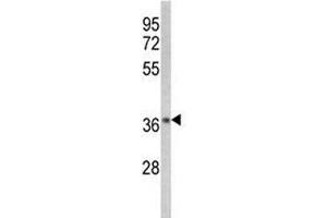 Western Blotting (WB) image for anti-Nuclear Factor of kappa Light Polypeptide Gene Enhancer in B-Cells Inhibitor, alpha (NFKBIA) (AA 12-41) antibody (ABIN3032048)
