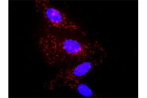 Proximity Ligation Analysis of protein-protein interactions between IL1B and A2M. (IL-1 beta antibody  (AA 1-269))