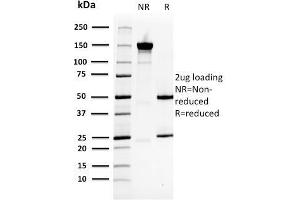 SDS-PAGE Analysis Purified HSP27 Mouse Monoclonal Antibody (CPTC-HSPB1-2). (HSP27 antibody)