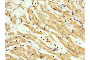 IHC image of ABIN7159457 diluted at 1:200 and staining in paraffin-embedded human heart tissue performed on a Leica BondTM system. (Cyclin M3 antibody  (AA 358-645))