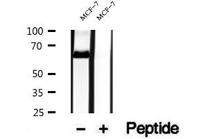 Western blot analysis of extracts of MCF-7 cells, using NR1D1 antibody. (NR1D1 antibody  (N-Term))