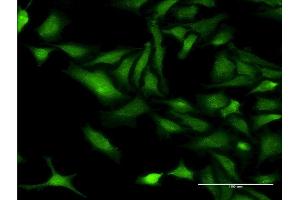 Immunofluorescence of monoclonal antibody to CHRNB3 on HeLa cell. (CHRNB3 antibody  (AA 128-223))