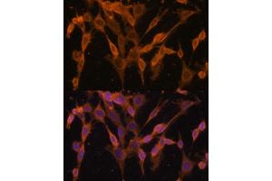 Immunofluorescence analysis of NIH/3T3 cells using UBQLNL antibody (ABIN7271125) at dilution of 1:100. (UBQLNL antibody  (AA 176-475))