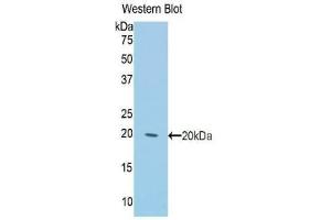 Detection of Recombinant KRT2, Rat using Polyclonal Antibody to Keratin 2 (CK2) (Keratin 2 antibody  (AA 368-507))