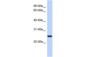 Western Blotting (WB) image for anti-Flavin Reductase (BLVRB) antibody (ABIN2463954) (BLVRB antibody)