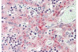 Immunohistochemistry (IHC) image for anti-Coagulation Factor 13, B Polypeptide (F13B) (Middle Region) antibody (ABIN2777104)