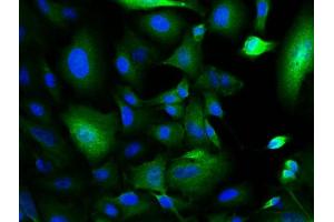 Image provided by One World Lab validation program. (XIAP antibody  (AA 201-330))