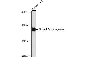 Western blot analysis of extracts of Mouse lung, using Alcohol Dehydrogenase Rabbit mAb (ABIN7265529) at 1:1000 dilution. (ADH1A antibody)