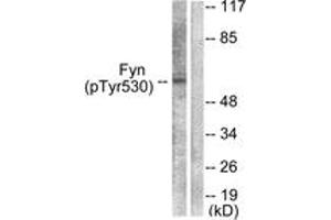 Western blot analysis of extracts from 293 cells treated with H2O2 100uM 15', using Fyn (Phospho-Tyr530) Antibody. (FYN antibody  (pTyr531))