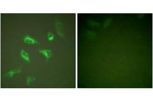 Immunofluorescence analysis of HeLa cells, using 14-3-3 zeta (Ab-58) Antibody. (14-3-3 zeta antibody  (AA 24-73))