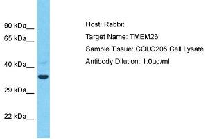 Host: Rabbit Target Name: TMEM26 Sample Type: COLO205 Whole Cell lysates Antibody Dilution: 1. (TMEM26 antibody  (C-Term))
