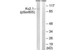 Western blot analysis of extracts from K562 cells treated with TNF 200ng/ml 30', using Kv2. (Kv2.1/KCNB1 antibody  (pSer805))