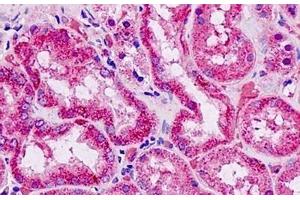 Human Kidney: Formalin-Fixed, Paraffin-Embedded (FFPE) (EFNA4 antibody  (AA 131-180))