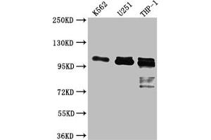 Western Blot Positive WB detected in: K562 whole cell lysate, U-251 whole cell lysate, THP-1 whole cell lysate All lanes: ITCH antibody at 1:1000 Secondary Goat polyclonal to rabbit IgG at 1/50000 dilution Predicted band size: 103, 99, 87 kDa Observed band size: 103 kDa (Recombinant ITCH antibody)