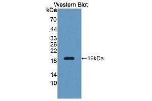 Western Blotting (WB) image for anti-WNT1 Inducible Signaling Pathway Protein 1 (WISP1) (AA 216-347) antibody (ABIN1176562) (WISP1 antibody  (AA 216-347))