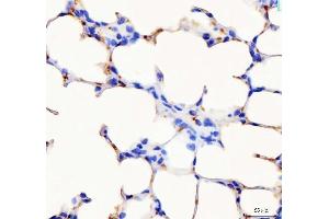 anti-Platelet Factor 4 (PF4) (AA 30-105) antibody