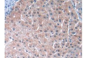 DAB staining on IHC-P; Samples: Human Liver Tissue (TUBE1 antibody  (AA 236-473))