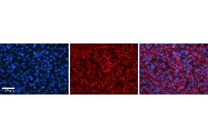 Rabbit Anti-HERC4 Antibody   Formalin Fixed Paraffin Embedded Tissue: Human Liver Tissue Observed Staining: Cytoplasm in hepatocytes Primary Antibody Concentration: N/A Other Working Concentrations: 1:600 Secondary Antibody: Donkey anti-Rabbit-Cy3 Secondary Antibody Concentration: 1:200 Magnification: 20X Exposure Time: 0. (HERC4 antibody  (Middle Region))