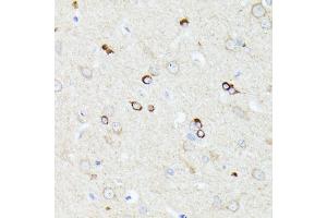 Immunohistochemistry of paraffin-embedded rat brain using CCDC6 antibody (ABIN7266442) at dilution of 1:100 (40x lens). (CCDC6 antibody  (AA 55-222))