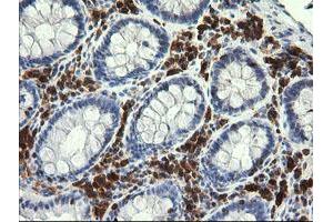Image no. 1 for anti-Phosphoinositide-3-Kinase, Catalytic, gamma Polypeptide (PIK3CG) antibody (ABIN1500202) (PIK3 gamma antibody)