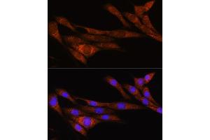 Immunofluorescence analysis of NIH/3T3 cells using  Rabbit pAb (ABIN7269965) at dilution of 1:100. (ARHGAP30 antibody  (AA 485-585))