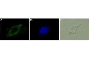 Expression of CB2 receptor in human LNCaP - Immunocytochemical staining of living human prostate carcinoma cells (LNCaP). (CNR2 antibody  (Extracellular, N-Term))