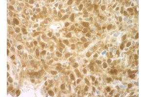 Immunohistochemistry (IHC) image for anti-Eukaryotic Translation Initiation Factor 4E Binding Protein 1 (EIF4EBP1) (C-Term) antibody (ABIN7448395) (eIF4EBP1 antibody  (C-Term))