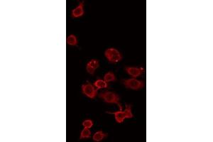 ABIN6275340 staining Hela by IF/ICC. (ZDHHC15 antibody  (C-Term))